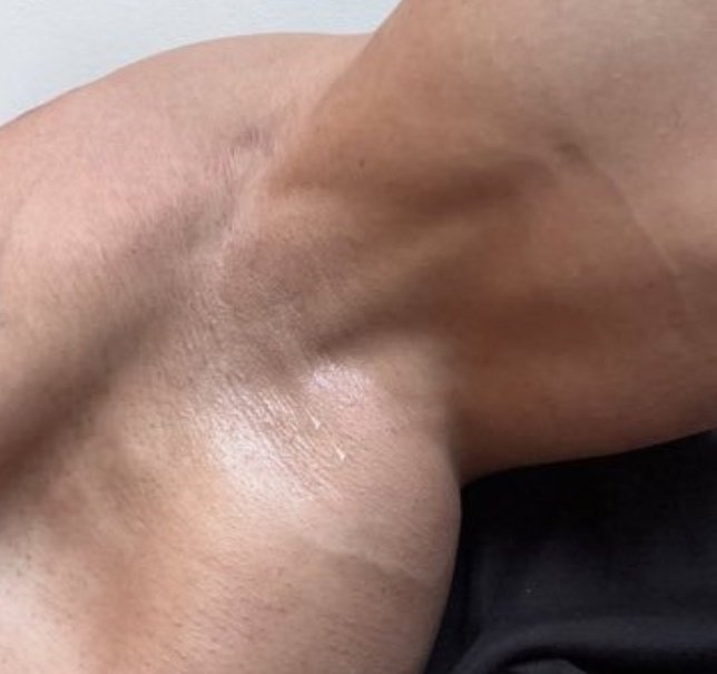 What part of the body is this??