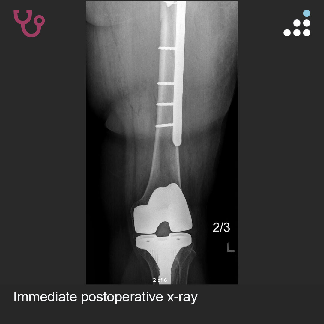 Orthobullets tweet media