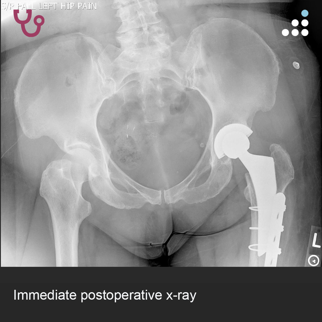 Orthobullets tweet media