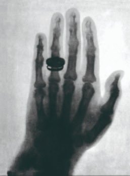 gav_rx's tweet photo. ✨ Bertha Röntgen 💜 #RX #Historia #8M #DiaInternacionalDeLaMujer #InternationalWomensDay2026 #Roentgen https://t.co/ZAz63bemag