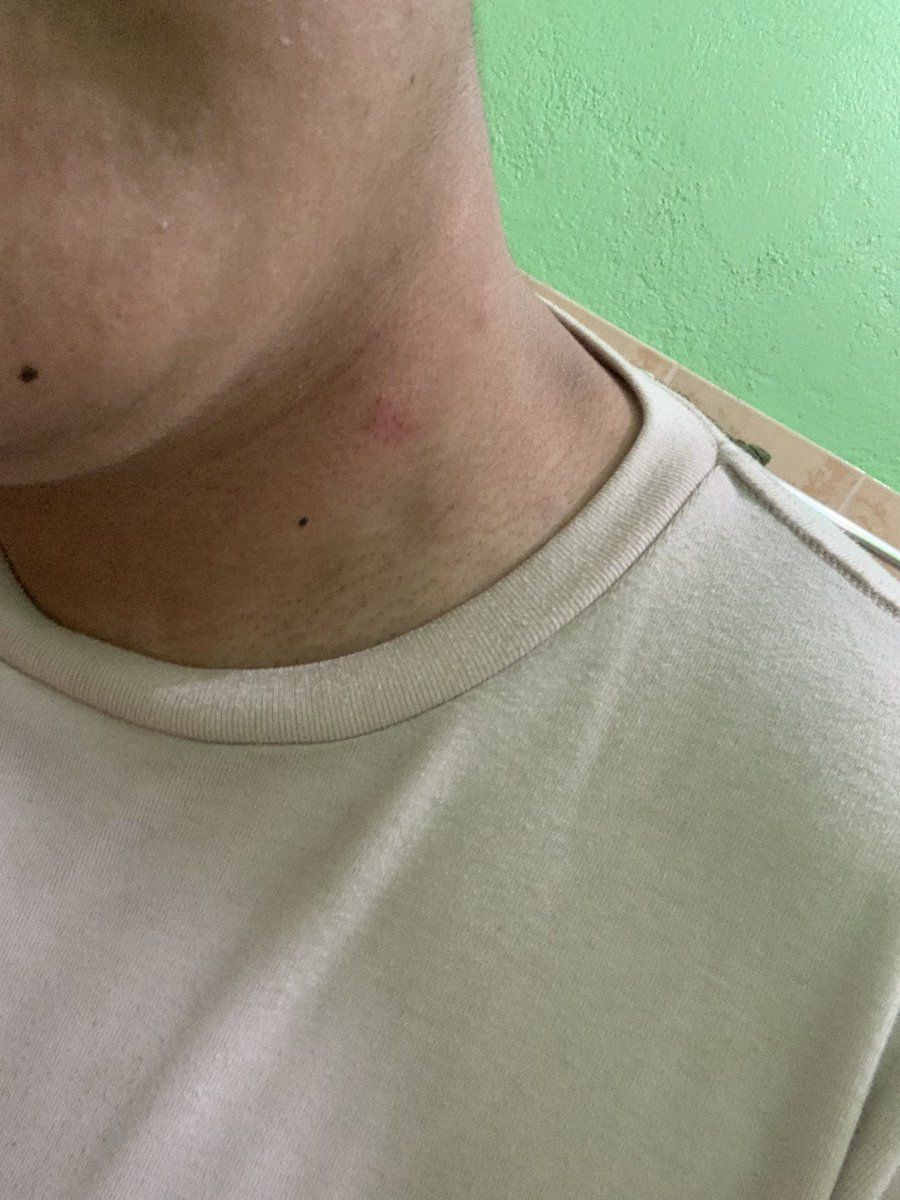 Alteregonileo's tweet photo. Ang bilis ako malagyan ng hickey shuta https://t.co/m4YZzHLvyM
