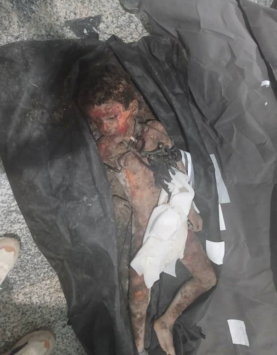 Me da igual si este niño es israelí, iraní, Ucraniano o ruso.

Es víctima de un bombardeo enemigo, ¿se entiende así?.