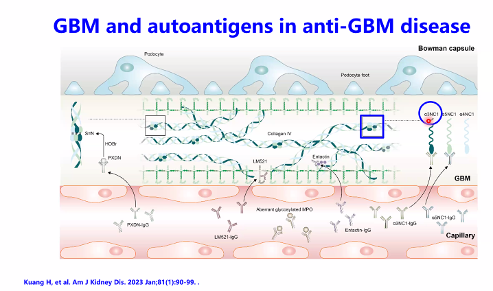 Tiffany Caza tweet media