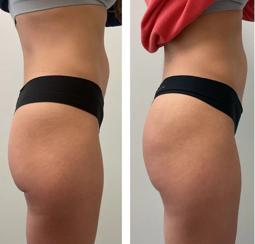 Medzonetv tweet media