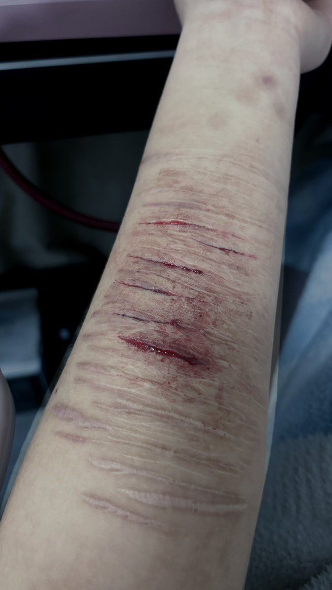 有痔者事竟成 tweet media