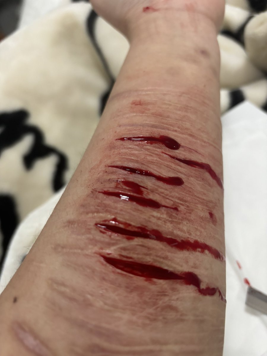 有痔者事竟成 tweet media