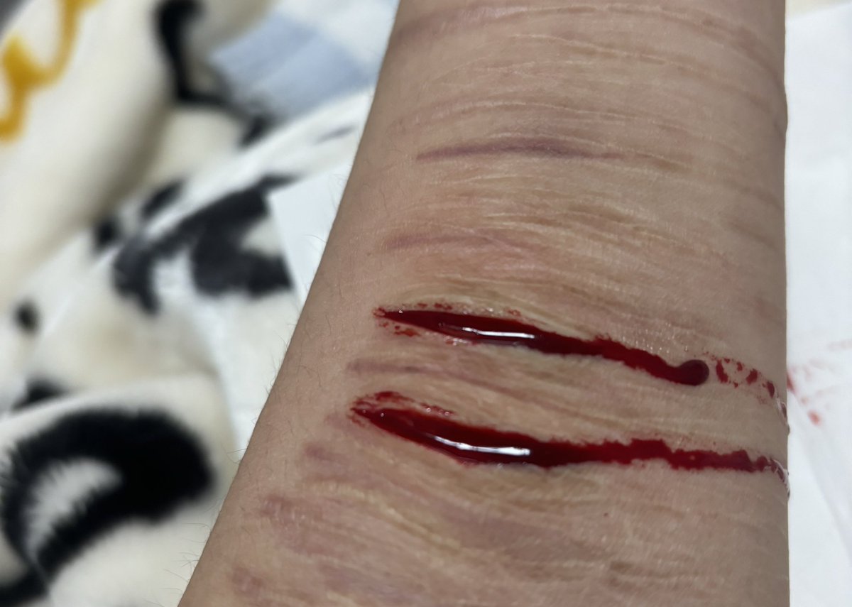 有痔者事竟成 tweet media