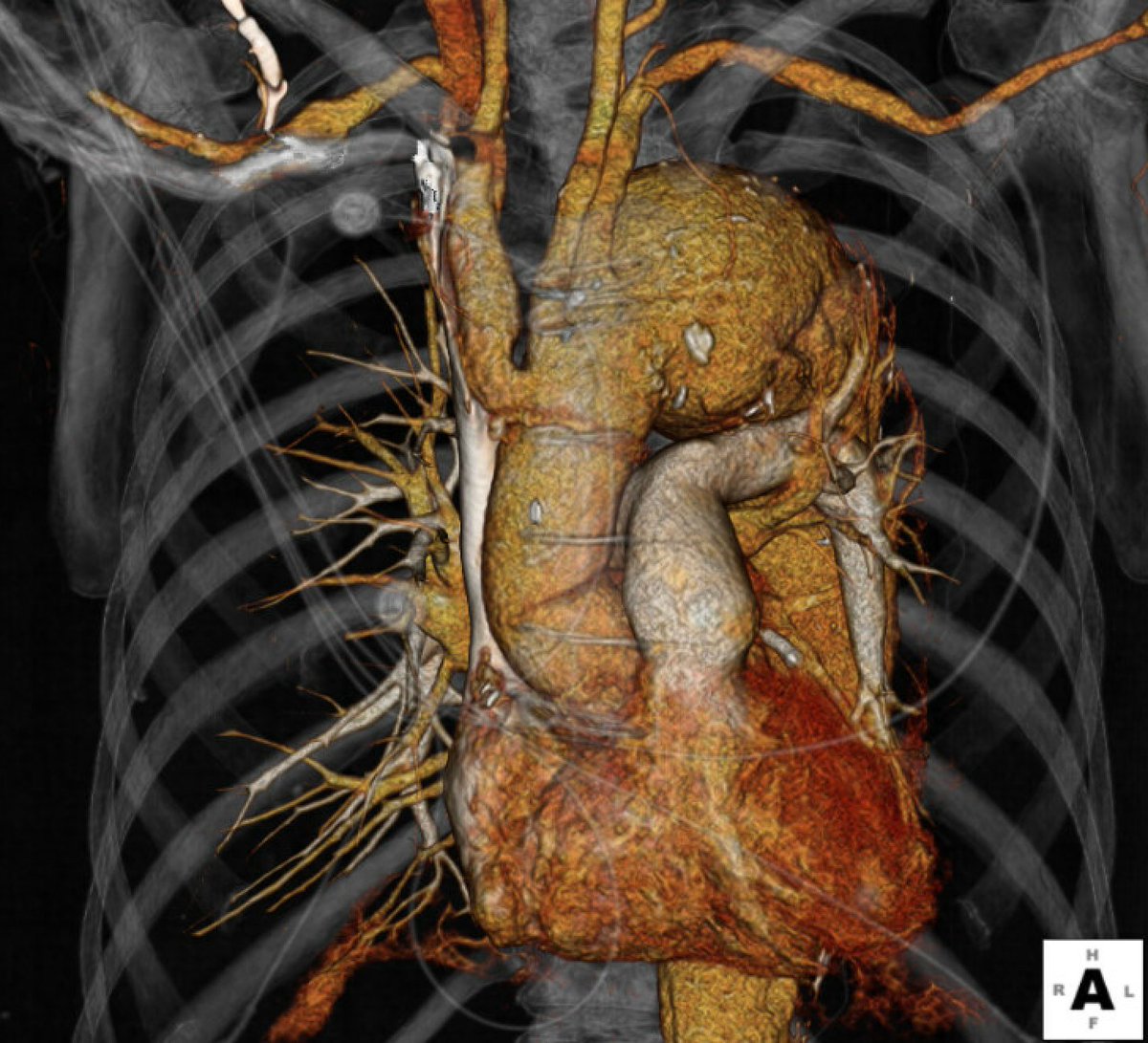 Adam W. Beck tweet media