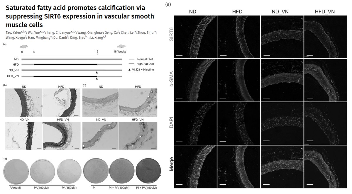 HaoYin20's tweet photo. #SIRT6 #VascularCalcification

Rat #HighFatDiet + VitD3 + Nicotine
▶️Aortic medial calcification &amp; ⏬SIRT6

SIRT6 overexpression ⏬Palmitic acid-induced #SmoothMuscleCell Apoptosis &amp; Osteogenesis

#JHyperten 2023
https://t.co/uqISZXnvMW https://t.co/CDcFCLCtOt