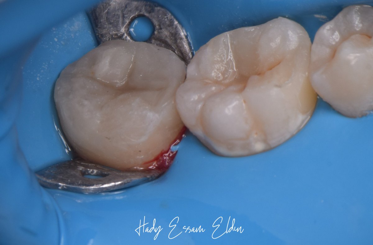 hadyessam10's tweet photo. بنصلح ال 6 وال 7 في السريع منه

Full case
Insta: https://t.co/7VkTYAH7jg

Fb: https://t.co/GIqFLpucGG https://t.co/wjlFWgyPVb