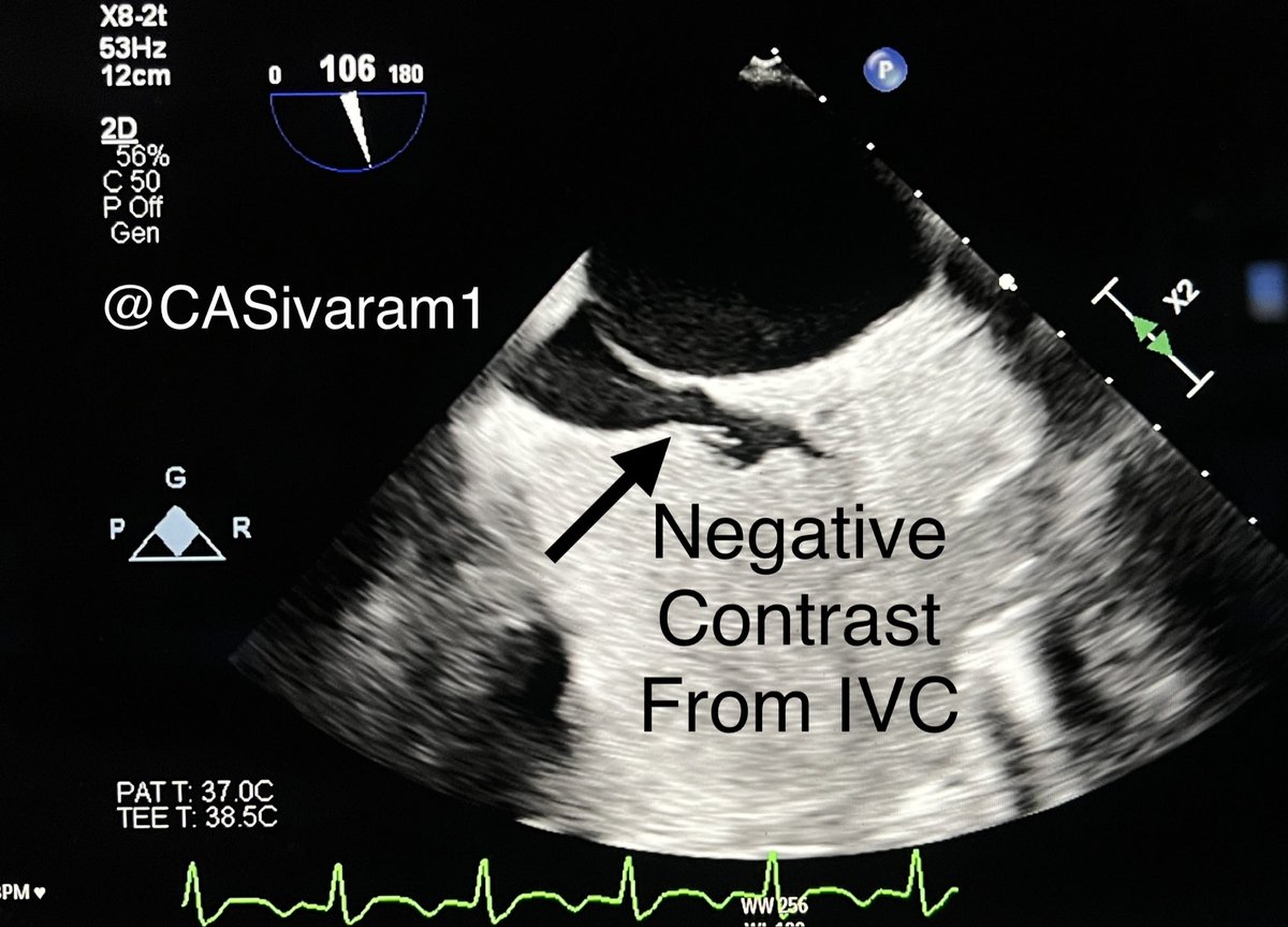 Chittur Sivaram MD MACP MACC tweet media