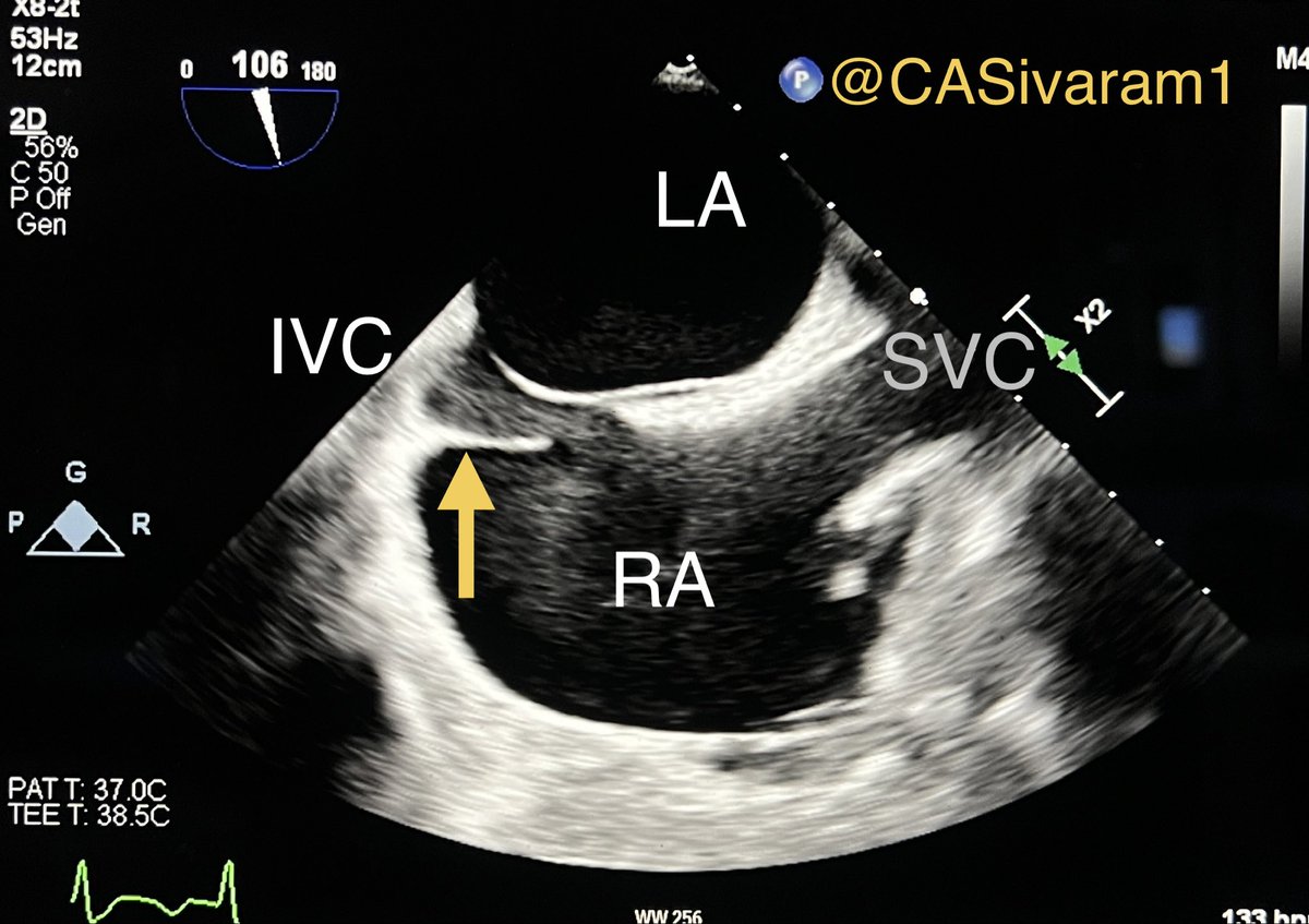 Chittur Sivaram MD MACP MACC tweet media