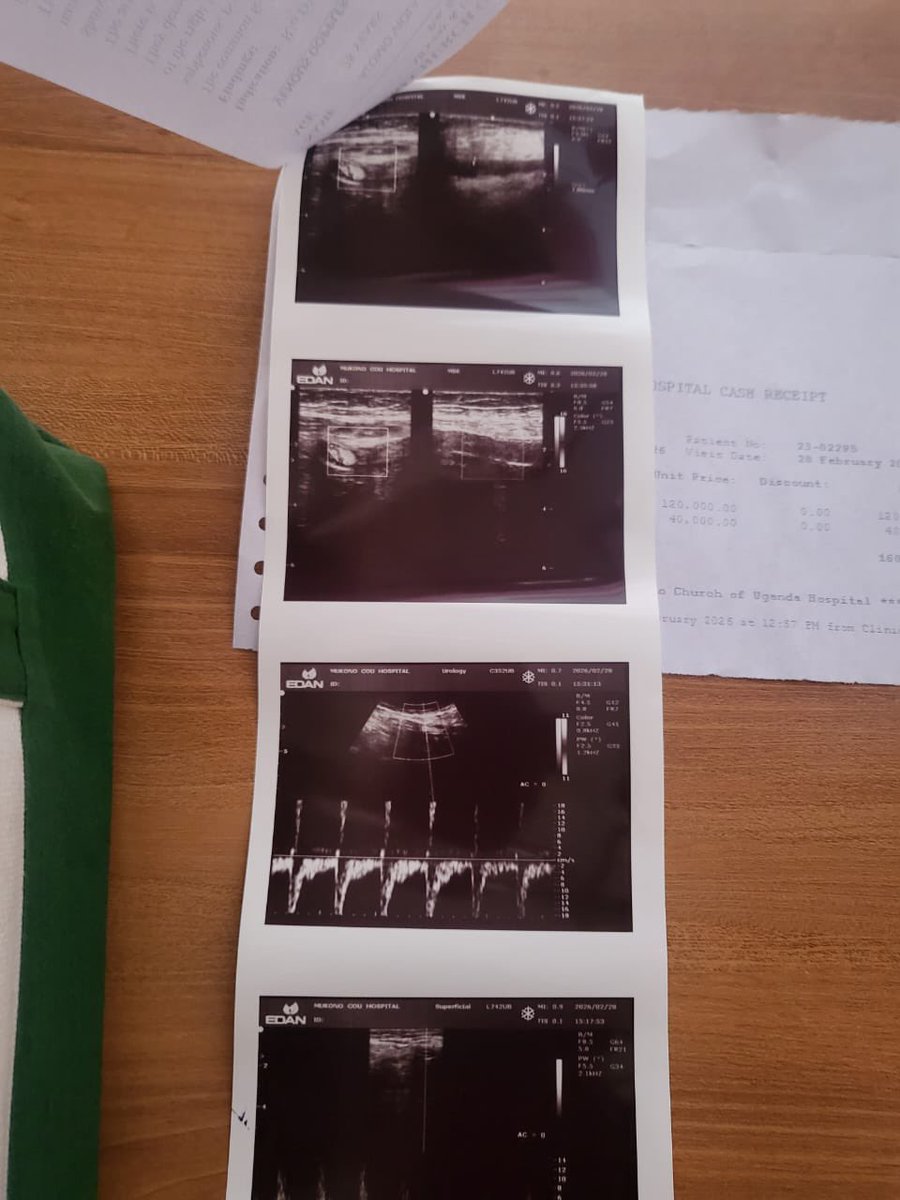 Jim Spire Ssentongo tweet media