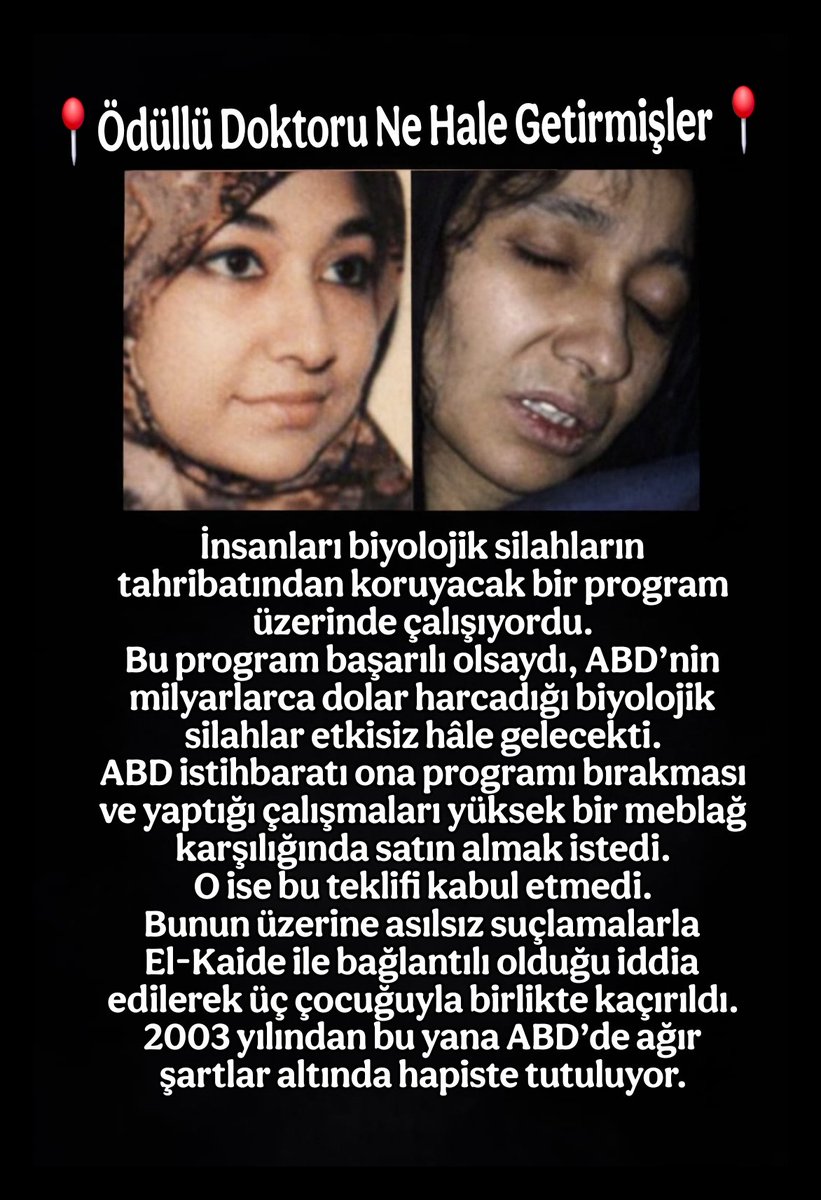 Onun seviyesinde ABD’de dahi bir tıp adamı yok ! Fakat yılın en başarılı kadın ödülünü alması gerekirken 2003’den beri ABD’de bir hücre hapsinde işkence görüyor ve tecavüze uğruyor!

#Kadın #8Mart #keşfet #Pakistan #ABD
