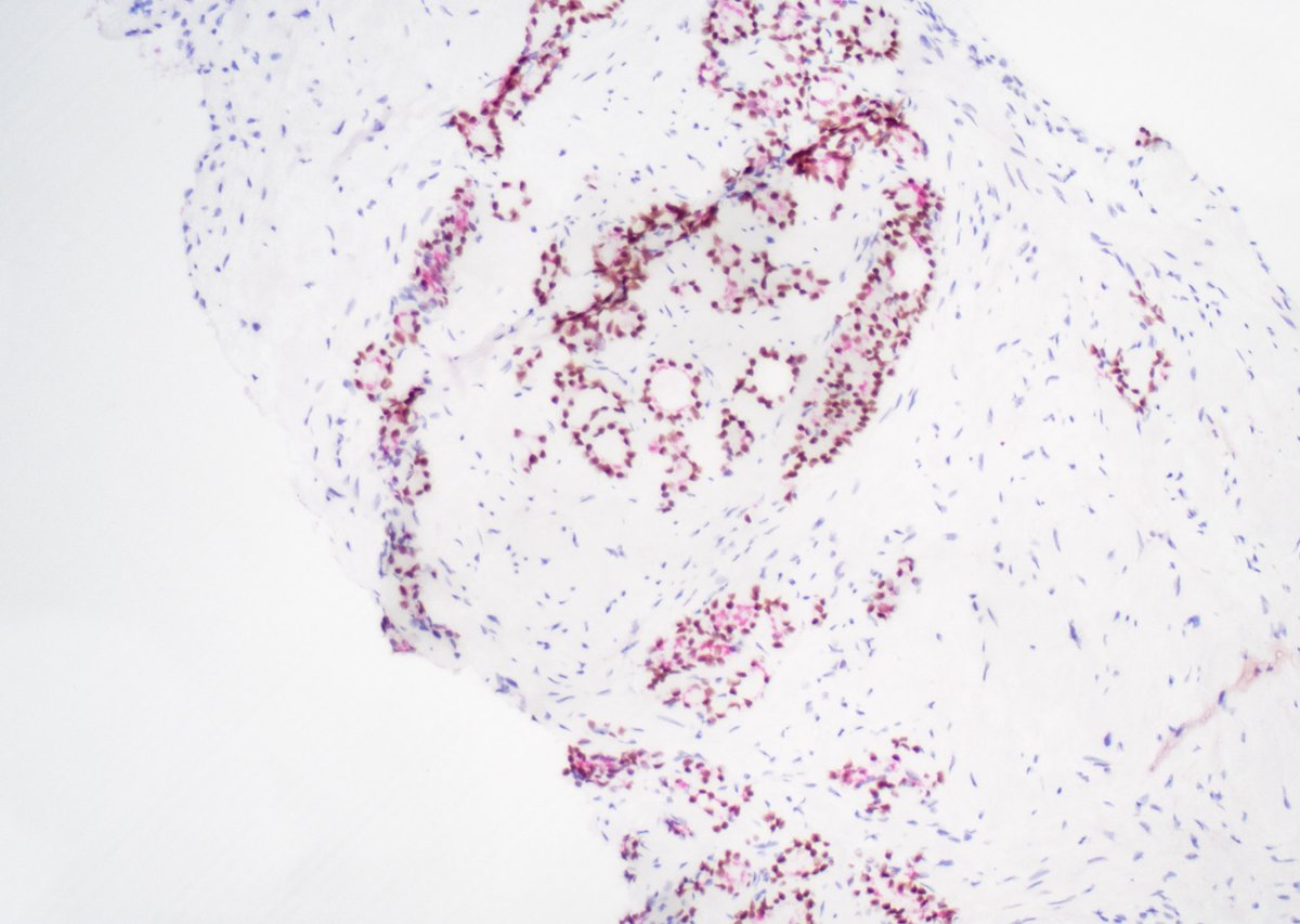 Guannan Zhang ，张冠楠，MD, PhD tweet media