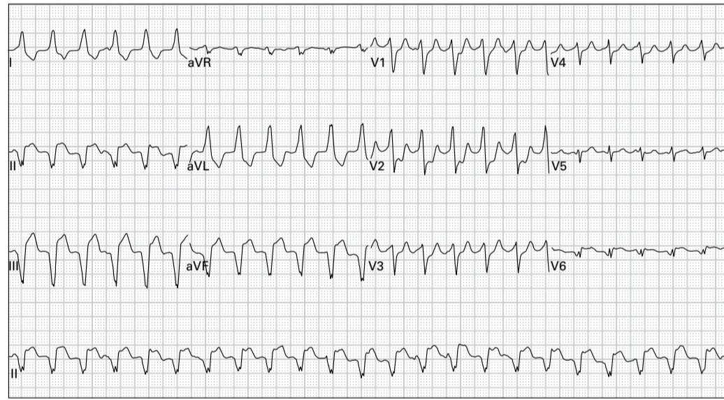 CardiovascularCorner tweet media