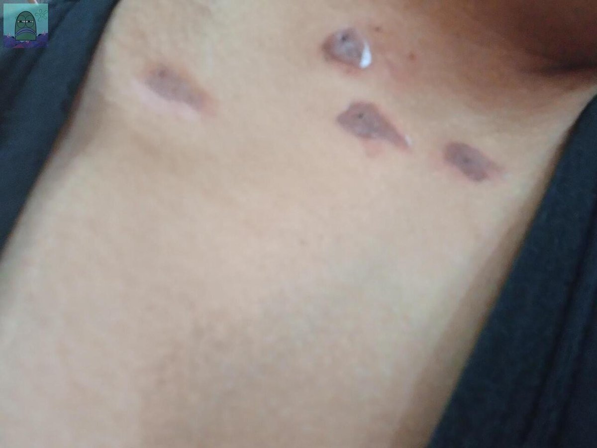 Tanyarl 💚 tweet media