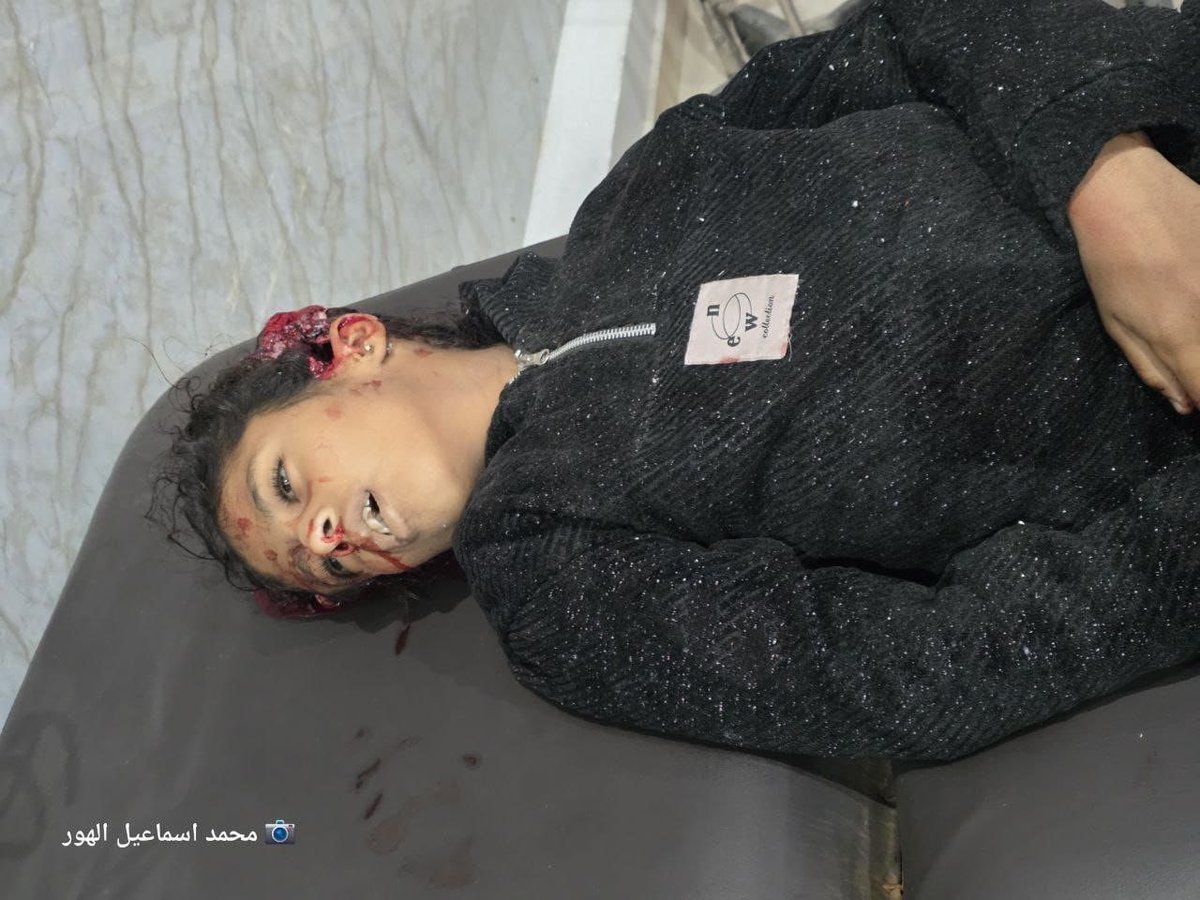 RamAbdu's tweet photo. Breaking: A child was killed moments ago in an Israeli strike on tents of displaced people in the Al-Sawariha area, central Gaza. https://t.co/HYZ6rk0txN