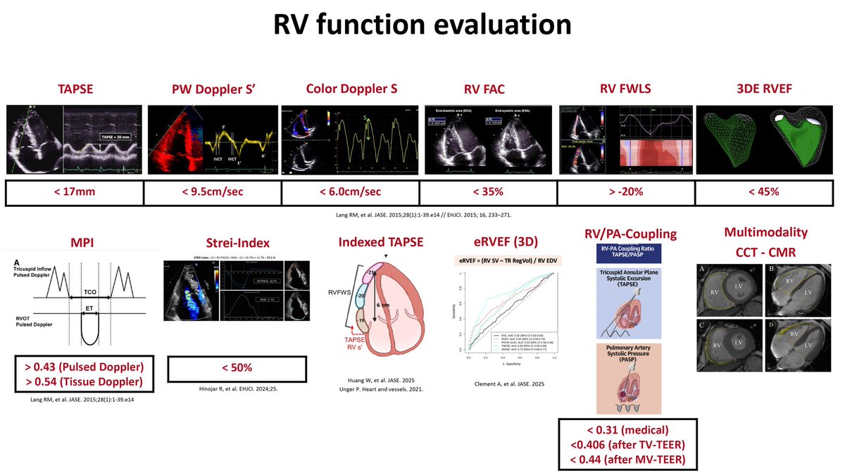 Review
Right Ventricular Function in Patients With Significant Tricuspid Regurgitation
doi.org/10.31083/RCM47… #cardiophile #MedEd #Cardiology #Pocus #Echofirst #echofirst