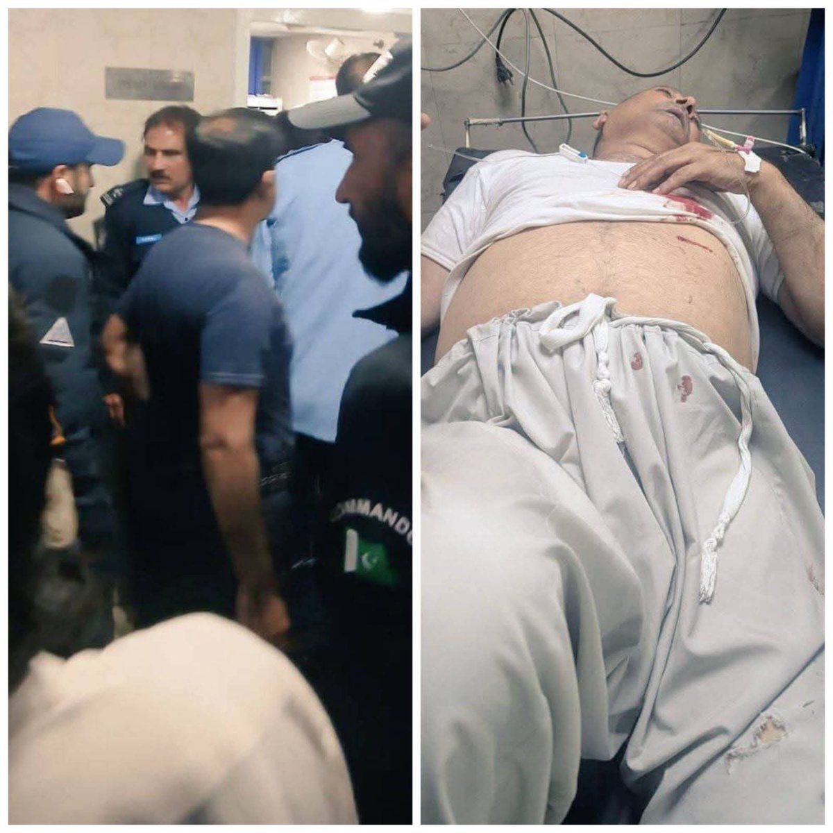 ShamimAshraf79's tweet photo. اسلام آباد: علی پور میں ڈی ایس پی پر قاتلانہ حملہ، ڈی ایس پی عمر حیات شدید زخمی، نامعلوم حملہ آور نے گھر کی گھنٹی بجائی۔ جیسے ہی دروازہ کھولا گیا تو ملزم نے اندھا دھند فائرنگ کر دی۔  ایک گولی ڈی ایس پی عمر حیات کے پیٹ میں لگی جس سے وہ شدید زخمی ہو گئے۔
#islamabad #ICTP #police https://t.co/33kW2zpxQm