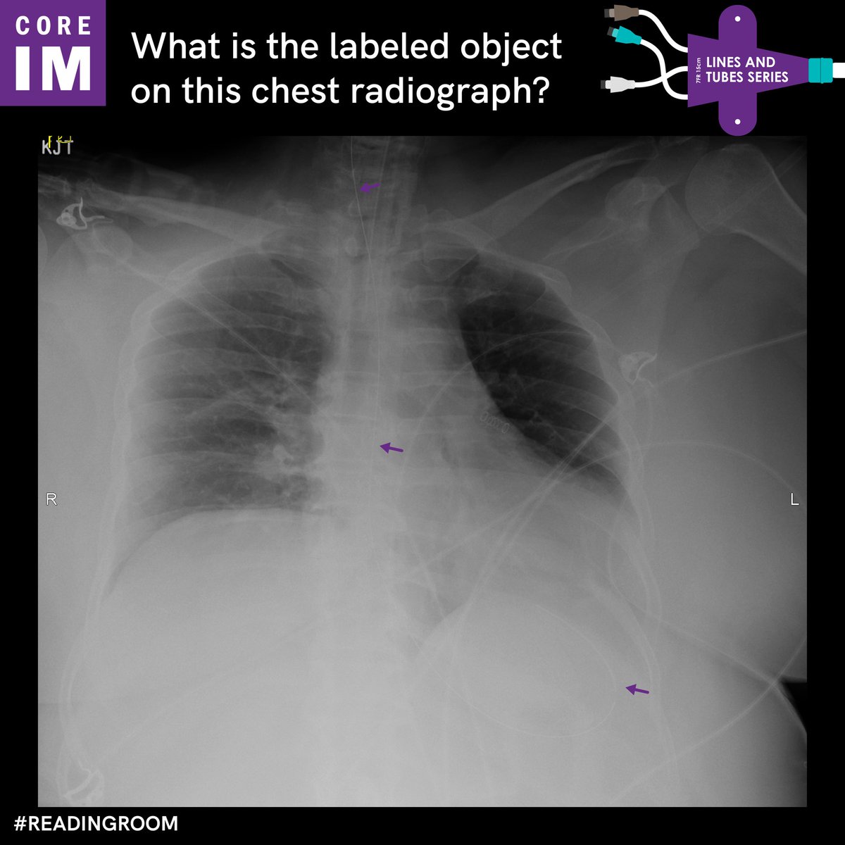 Hassler S. Macías-Sánchez tweet media
