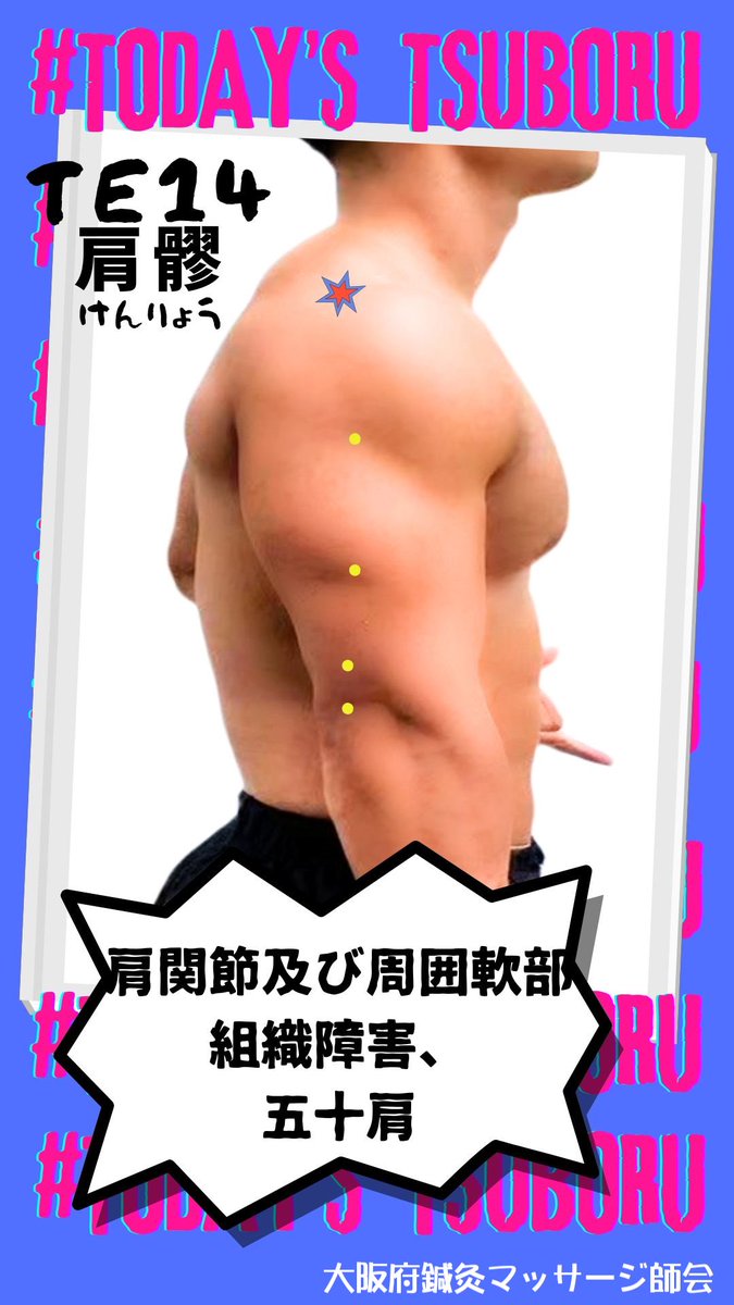 osmk_osaka's tweet photo. 今日のつぼる　#肩髎　#TE14

#大阪府鍼灸マッサージ師会
#大阪府東洋療法協同組合
#鍼灸マッサージちゃんねる
#今日のつぼる君
#鍼灸好きな人とつながりたい
#鍼灸 #マッサージ
#東洋医学 #ツボ
#健康 #未病
#セルフケア
#acupuncture https://t.co/08QCgkyKdG