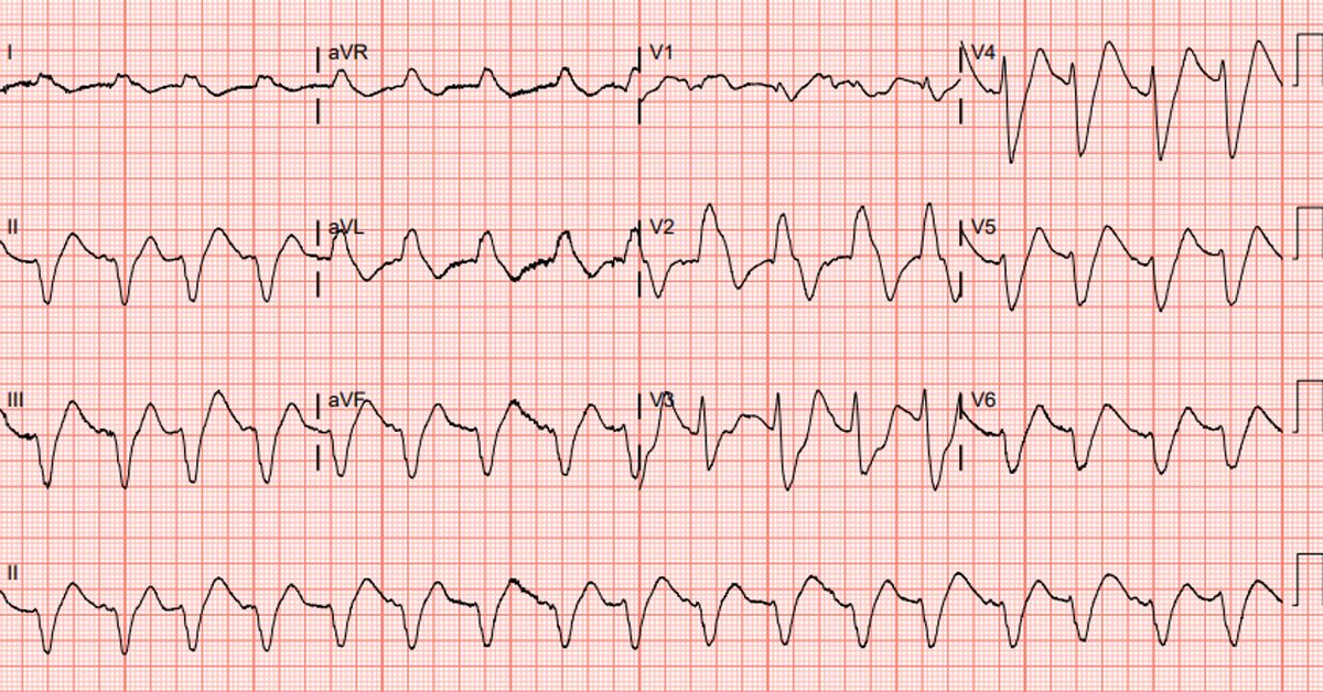 Justin Haloot tweet media