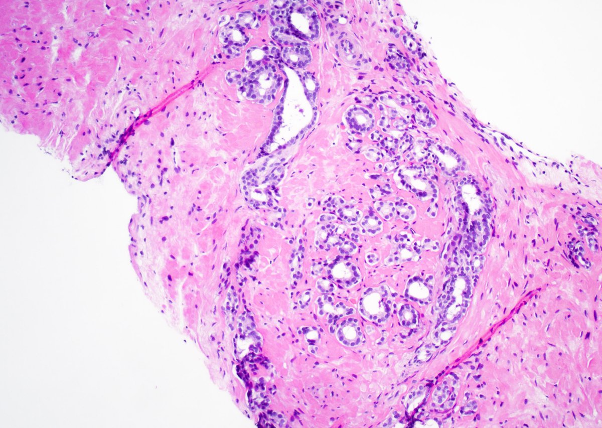 Guannan Zhang ，张冠楠，MD, PhD tweet media