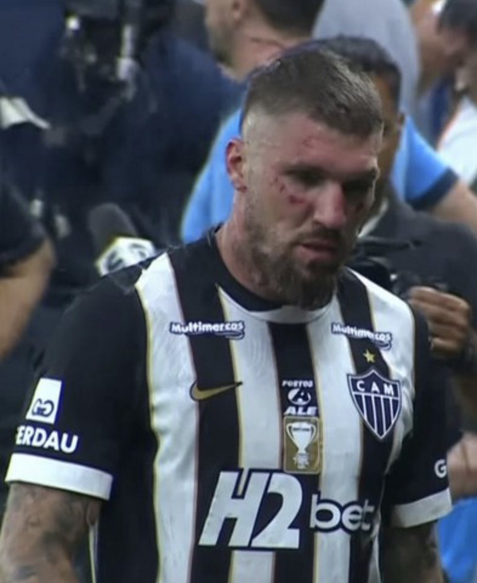 Essa foto não é montagem 

Apanhou igual puta 🍗