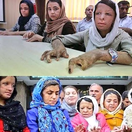 TayyarShahin's tweet photo. #عکس_جنگ_نیست و دختران مدرسهٔ شین آباد مجروحان جنگی نیستند؛
دختربچه‌هایی بودند که #آخوند برای مدرسه‌شون، در سرمای سخت آذربایجان شرقی، امکانات گرمایشی استاندارد فراهم نکرده بود. https://t.co/4oq9gHnJsx