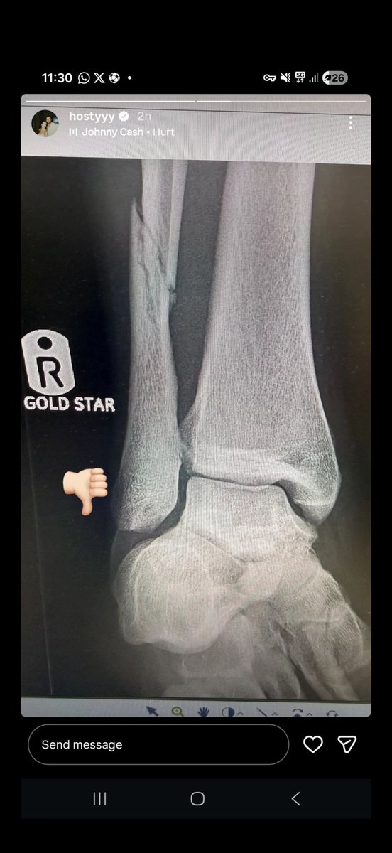 Super League Injuries 2026 tweet media