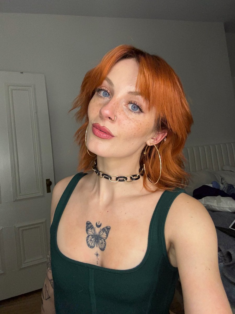 Kidney Girl tweet media