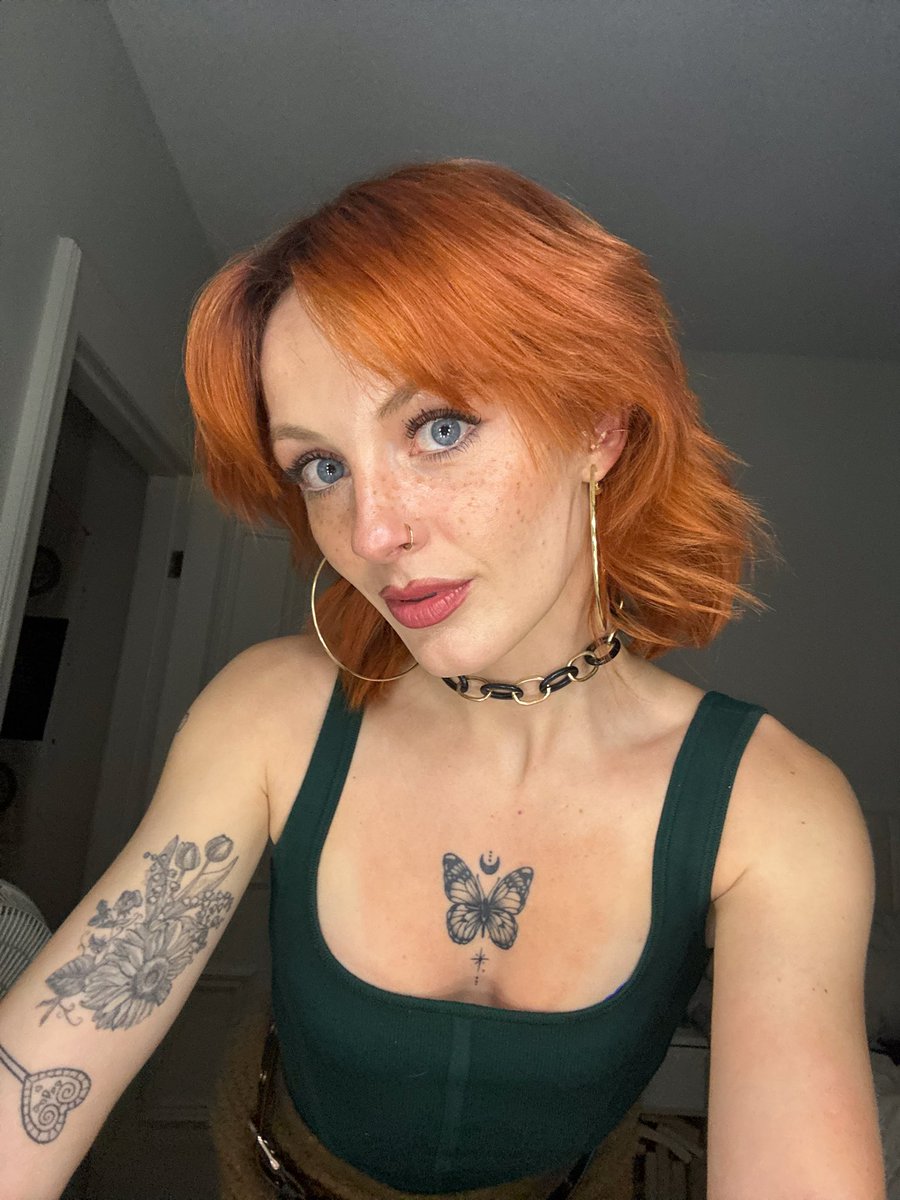 Kidney Girl tweet media