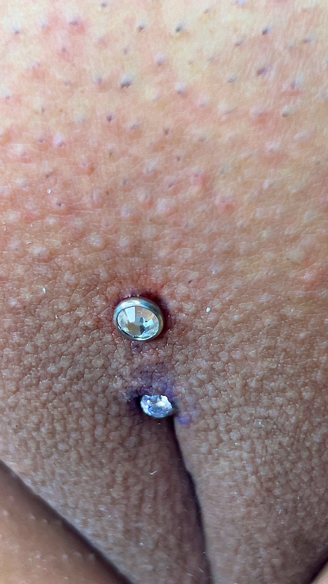 Dulcepiercer's tweet photo. ✨Perforación Cristina✨ 

Se ubica justo donde se unen los labios mayores, sobre el monte de Venus. Es una perforación principalmente estética que resalta mucho la anatomía íntima.
Hagámosla ✨✨✨���🩷🩷 https://t.co/vDDTSVzIII