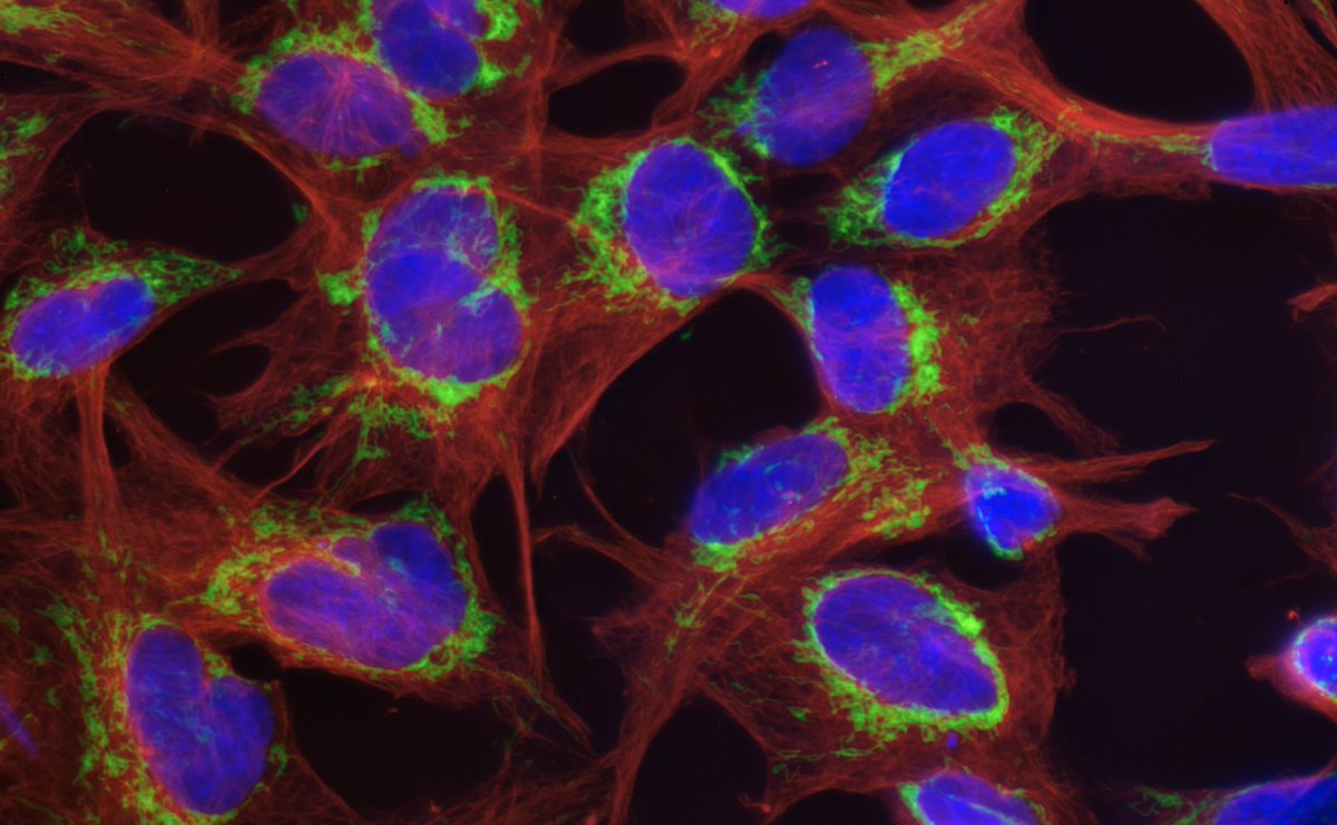 Optolongfilter's tweet photo. New Optical Scientific Photographic Artist / Amateur photomacrographer, @Daniel Han, who joins us as an important tester, shared the tested images below and tested the Seaweed chloroplasts found in rock pools.
DAPI Fibroblast cells (huFIB). https://t.co/m4IB7TOqSJ