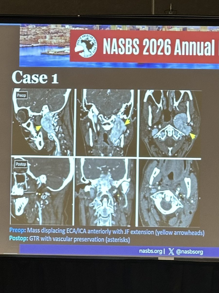 James K. Liu, MD tweet media