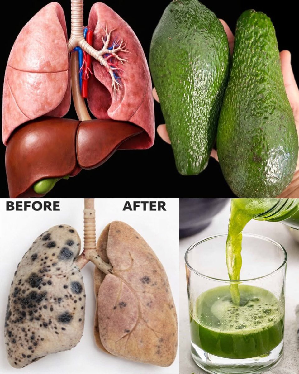 pureHerb Remisies tweet media