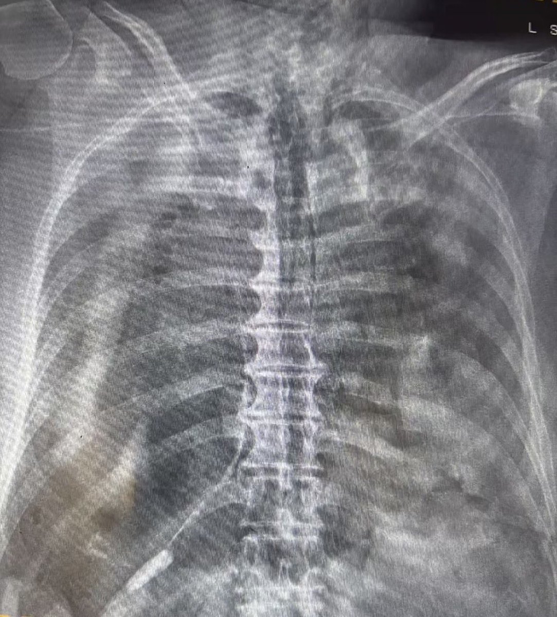 Oren Gottfried, MD tweet media