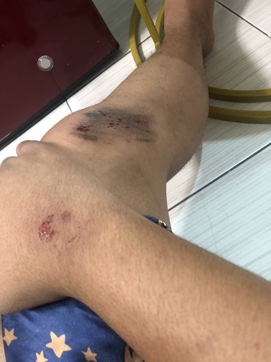 reynbow02_'s tweet photo. I was reminded by fate of this feeling — pain
And sometimes it’s okay to get hurt
Accept and move forward
Manhid na ata ako eh😅 https://t.co/kpdh7xqEqM