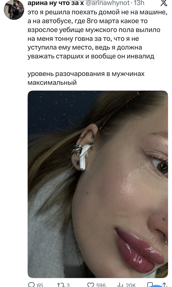 Уровень закачанного в губы говна - максимальный!