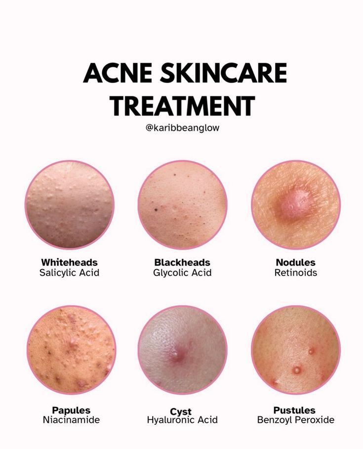 pijah noona tweet media