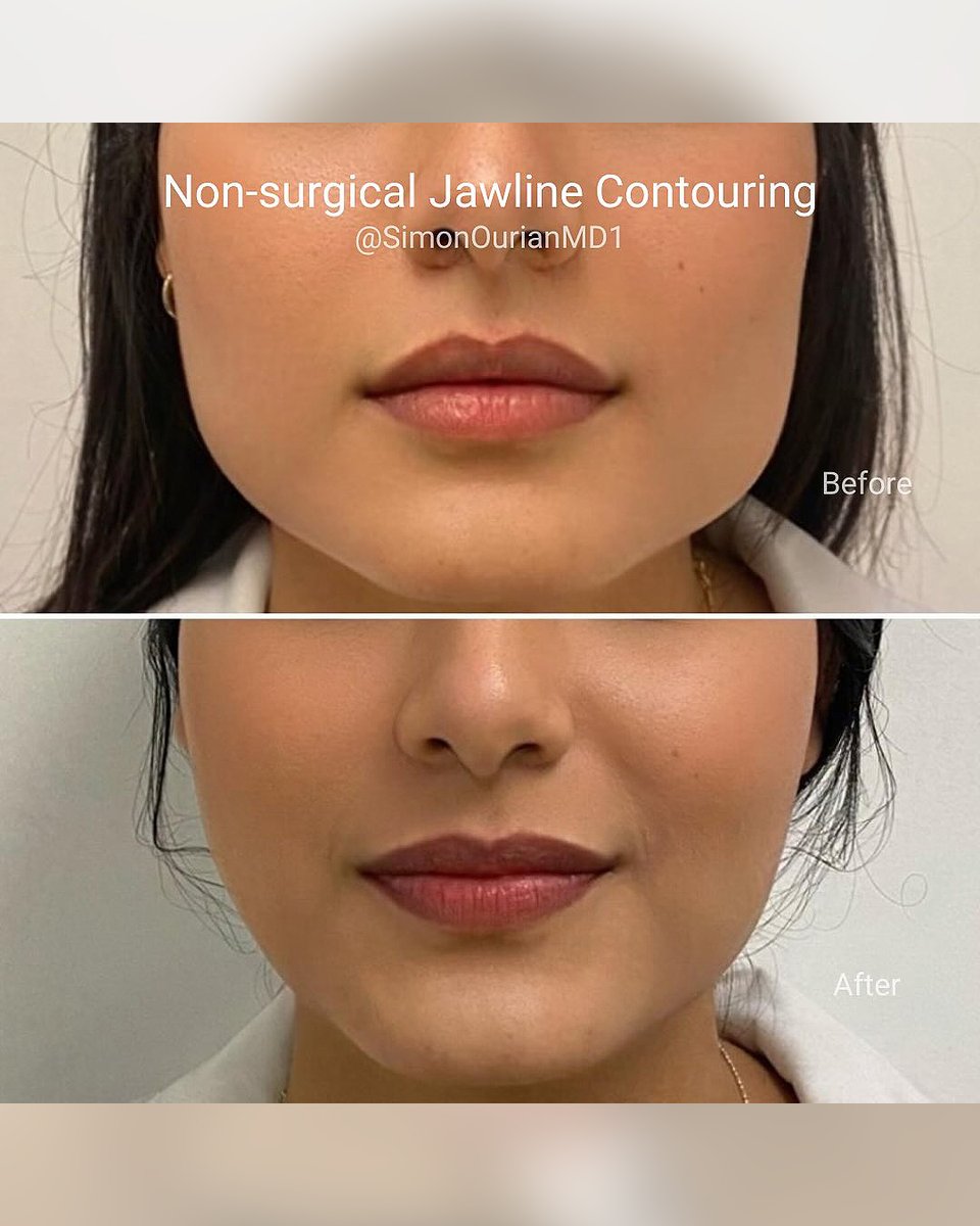 Dr. Simon Ourian - Epione tweet media