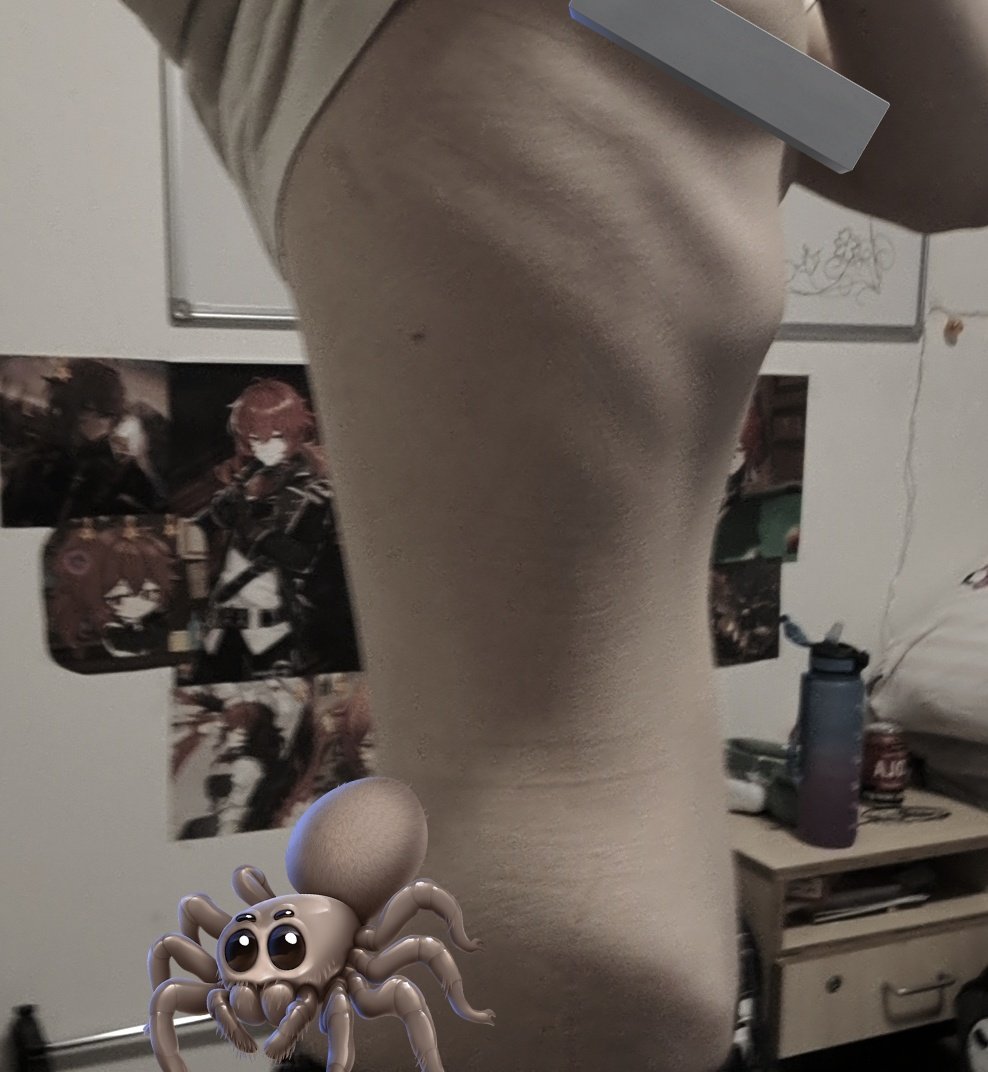 𐔌 ᛝ 𝓥alentin .ᐟ 🖤 inpatient/recov tweet media