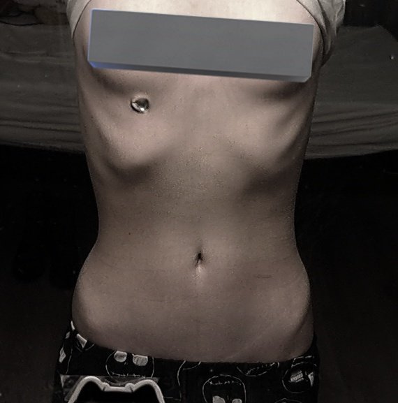 𐔌 ᛝ 𝓥alentin .ᐟ 🖤 inpatient/recov tweet media