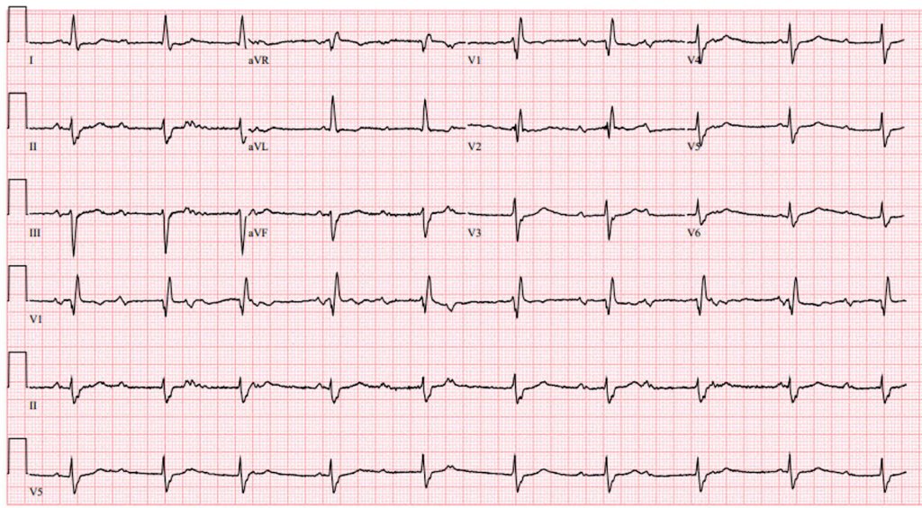 ECGWeekly tweet media
