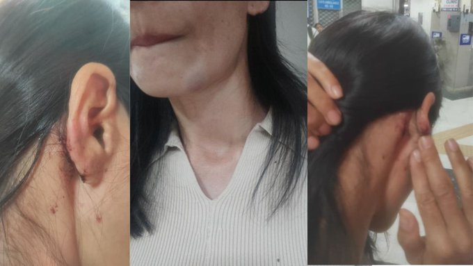 ManipurRising's tweet photo. The assault on 2 Northeast women near Saket Court in Delhi after racial harassment is deeply disturbing.
Such incidents expose the prejudice many from the Northeast still face outside their home states. India’s diversity is our strength, racism against fellow citizens must end. https://t.co/oJHNjICpyl