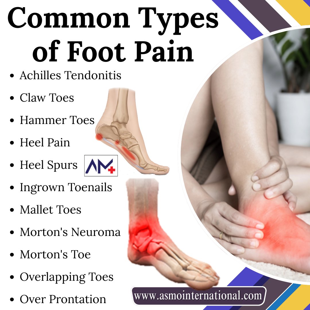 ashimamunjal05's tweet photo. Common Types of Foot Pain
.
https://t.co/9yLJI3L2y1
.
#FootPain #HeelPain #ArchPain #AnklePain #PlantarFasciitis #AchillesTendonitis #FlatFeet #FootInjury #FootProblems #FootHealth #JointPain #MusclePain #healthcare #asmointernational #asmohealth #asmomedicines #asmocare https://t.co/Ng6d4yRLIE