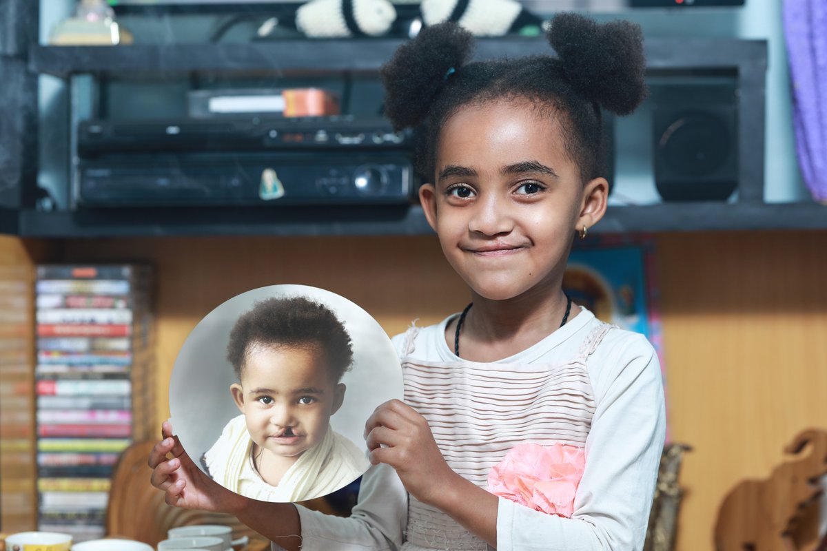 SmileTrainAfric's tweet photo. Smile Train fights stigma around #cleft lips and palates in Africa. We raise awareness that clefts are treatable, creating a better world for #CleftWarriors. Know someone with a cleft? Contact Africa@smiletrain.org. https://t.co/H0d1BqD1Vn