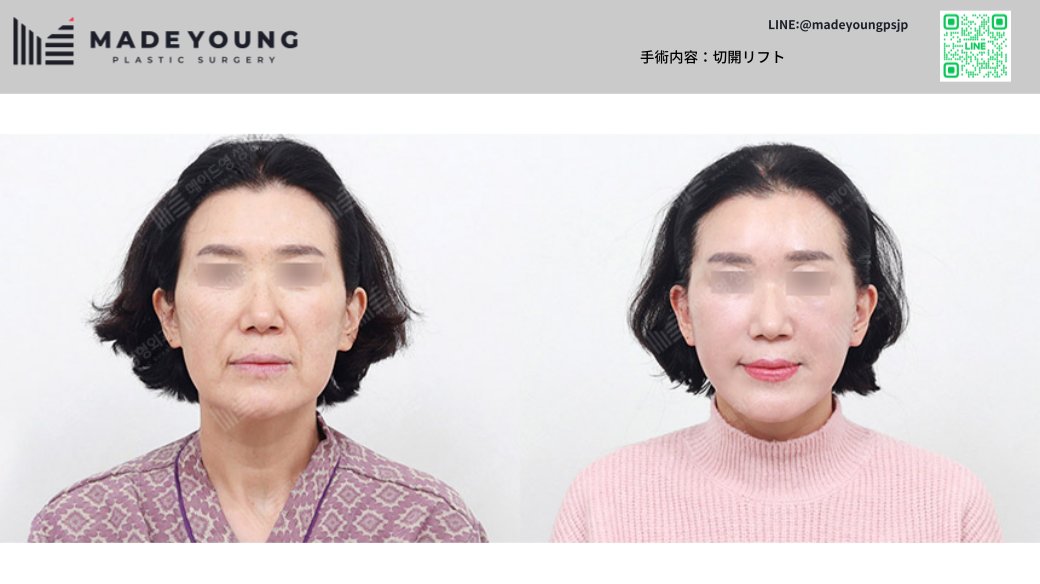 ［公式］メイドヤング美容外科 tweet media