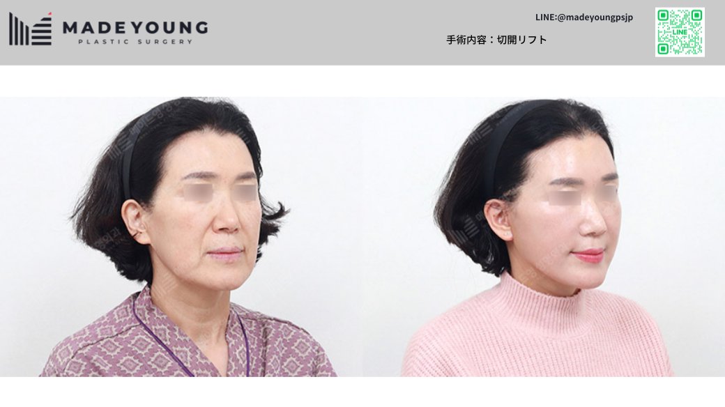 ［公式］メイドヤング美容外科 tweet media